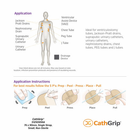 CathGrip® Tube Securement Device