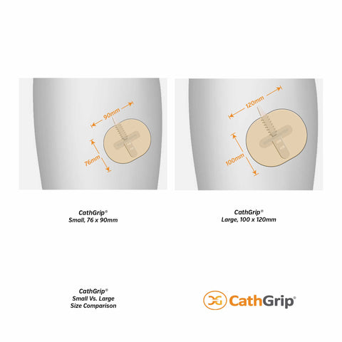 CathGrip® Tube Securement Device